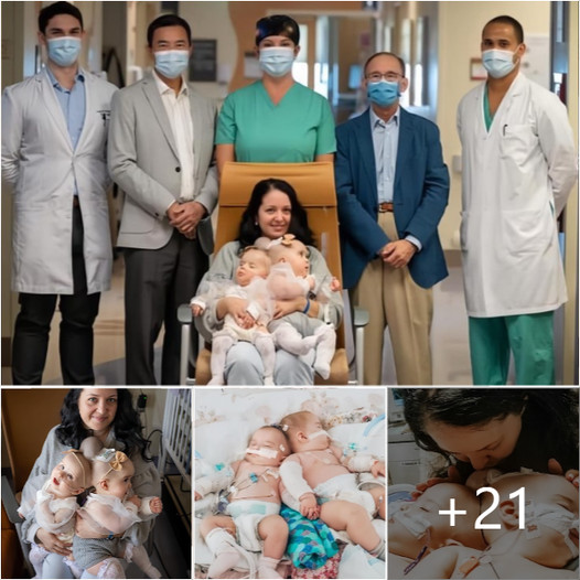 Unveiling the Miracle: 9-Month-Old Conjoined Twins Triumph Over the ...